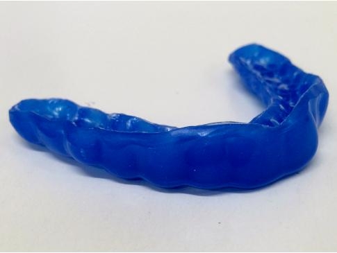 バスケットボール マウスピース作成事例・怪我を守るため｜マウスガード